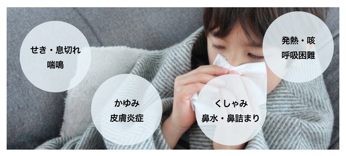 住環境のコントロールとアレルギーの関係について